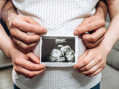 Eine Person hält ein Ultraschallbild in den Händen. Die Hände sind von zwei anderen Personen umschlossen, die das Bild ebenfalls betrachten. Die Person, die das Bild hält, trägt ein weißes, gepunktetes Hemd. Das Ultraschallbild zeigt ein Baby im Mutterleib.